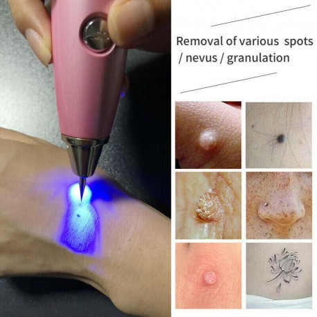 دستگاه پلاسما پن (بیوتی پن) 9 قدرته 2 چراغه ساخت آلمان Laser Freckle 9 Level Tattoo Plasma Pen